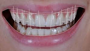 Odontologia estética